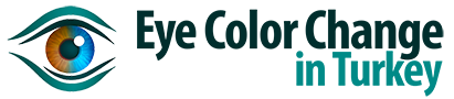 eye-color-change-in-turkey-logox90