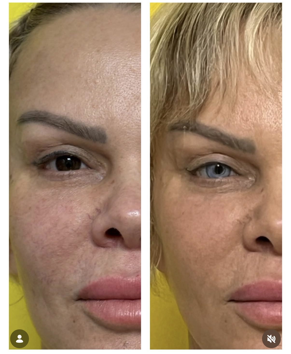 “Ultimate Guide to Permanent Eye Color Change: What You Need to Know”